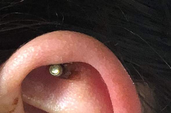 Gel piercing wildfleisch tyrosur Piercing entzündet