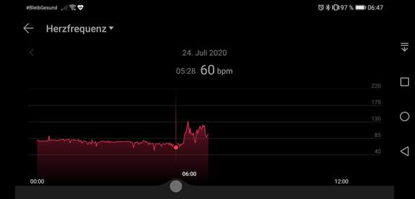 Hoher Puls Nach Den Aufstehen Gesundheit Und Medizin Gesundheit Schlafen Hoher Puls Nach Den Aufstehen Gesundheit Und Medizin Gesundheit Schlafen