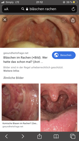 Blaschen Am Rachen Was Jetzt Gesundheit Und Medizin Gesundheit Blaschen Am Rachen Was Jetzt Gesundheit Und Medizin Gesundheit