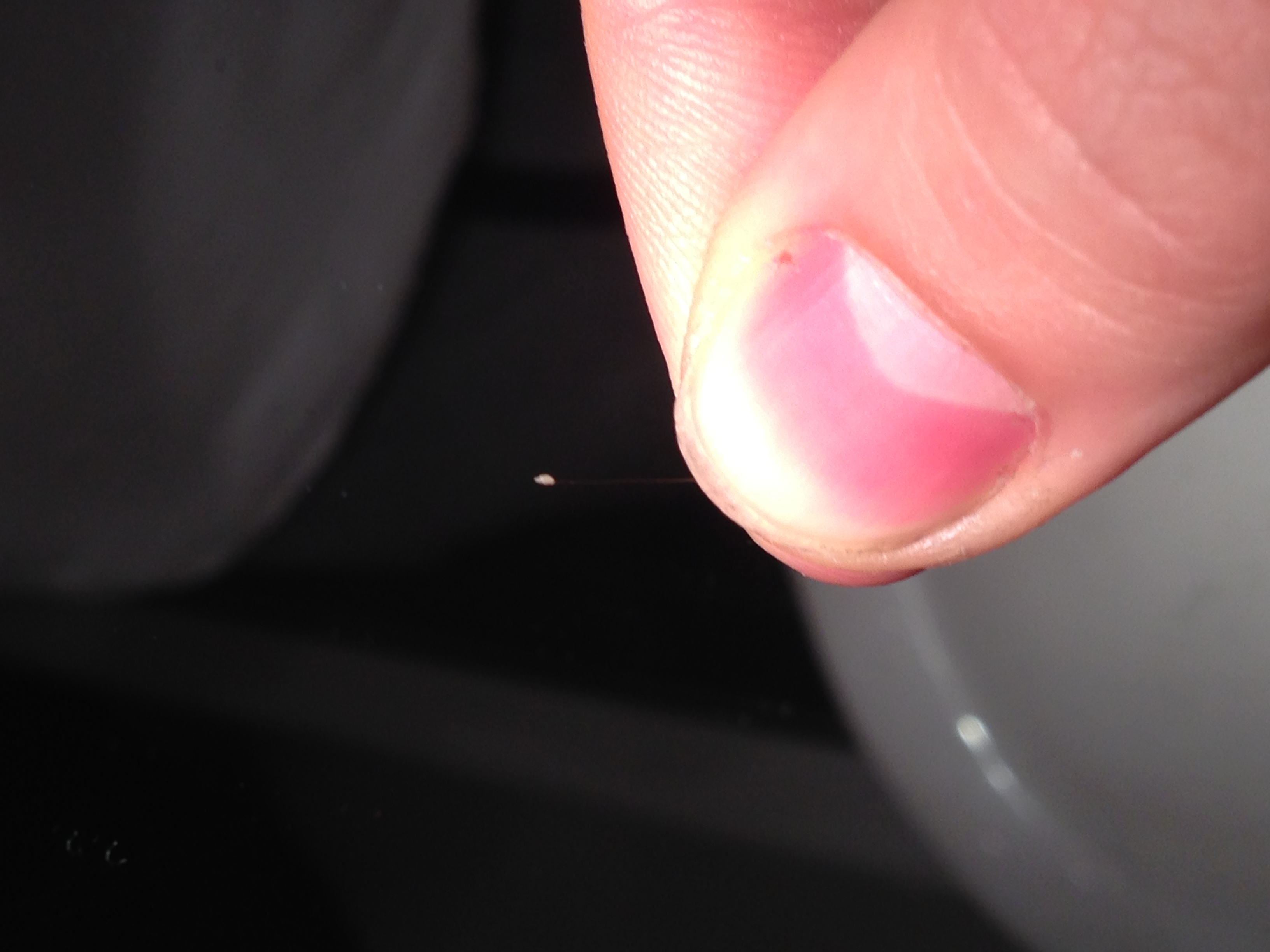 haare haarausfall schuppen