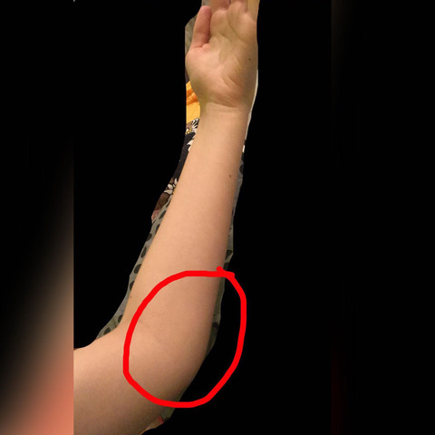 Schmerzen Im Arm Was Konnte Es Sein Gesundheit Und Medizin Arzt Krankheit Schmerzen Im Arm Was Konnte Es Sein Gesundheit Und Medizin Arzt Krankheit
