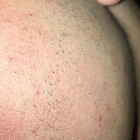 schnell wachst der bart nach