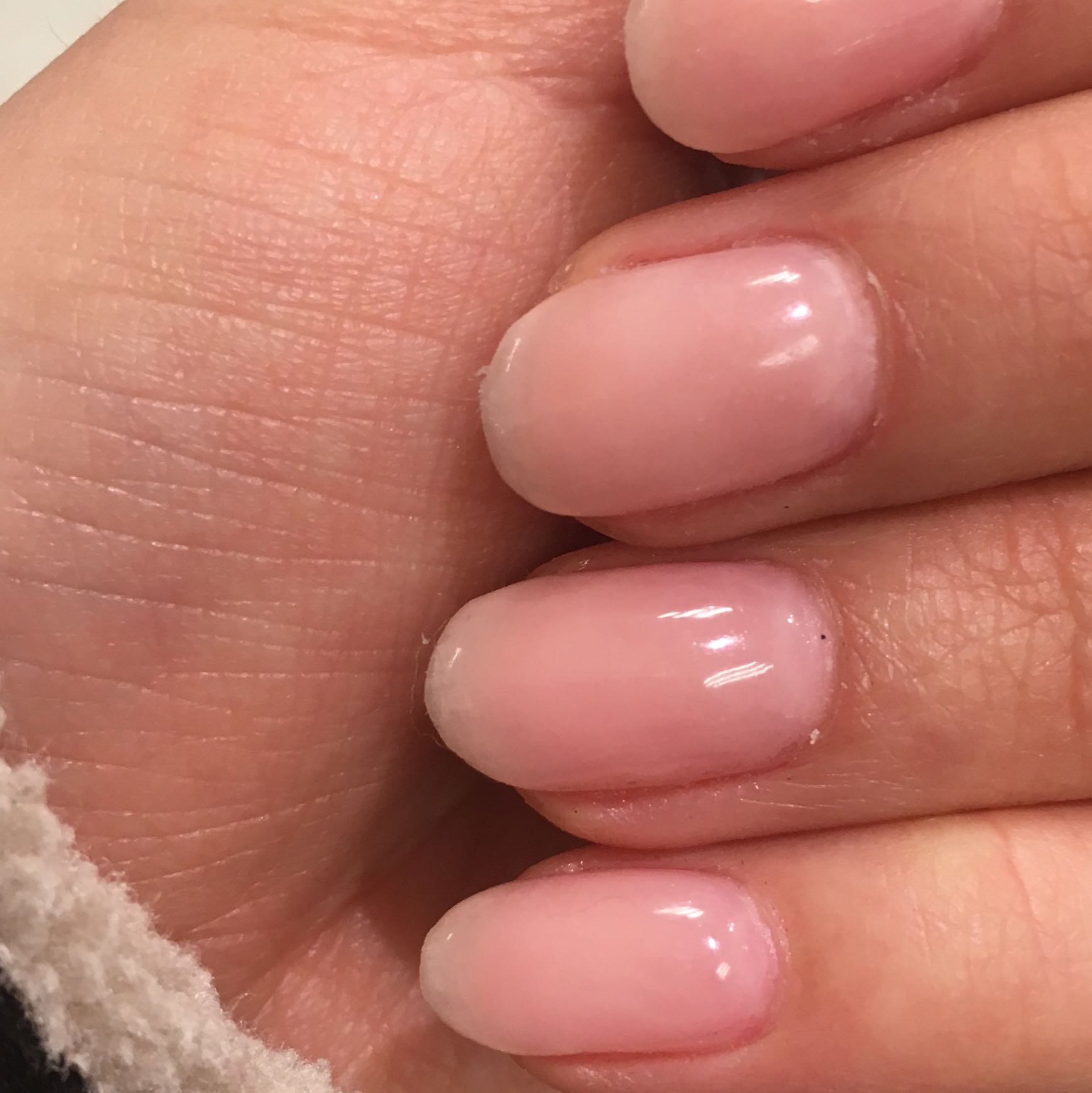 1 Mal Gelnagel Schmerzen