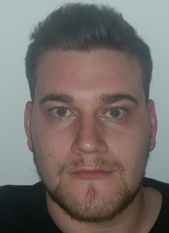 2 Fragen Wie Werde Ich Die Falten Zwischen Meinen Augen Und Meiner Nase Los Warum Wird Meine Wange Nicht Schmaler Wangen