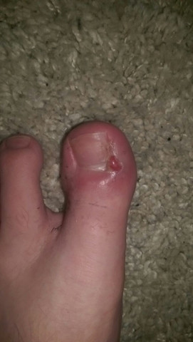 Wildes Fleisch Die Meistgelesenen Fragen Wildes Fleisch Die Meistgelesenen Fragen