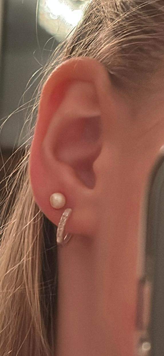 Wie Lange Dauert Es Bis Ein Ohrloch Zuwächst 2tes ohrloch zu nah? (Piercing, Ohr, Schmuck)