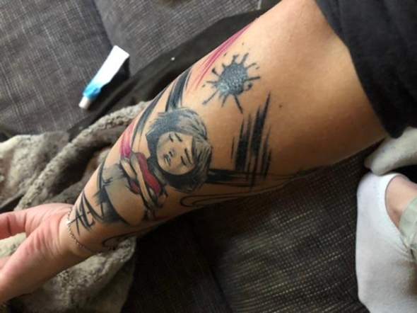 3 Wochen Altes Tattoo Juckt Wie Holle Und Ist Dick Vor Allem An Der Roten Farbe Allergie 3 Wochen Altes Tattoo Juckt Wie Holle Und Ist Dick Vor Allem An Der Roten Farbe Allergie