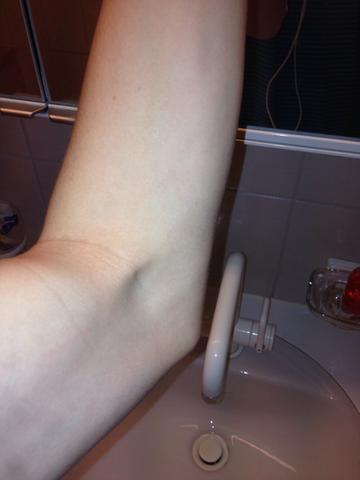 training - (Training, oberarm)
