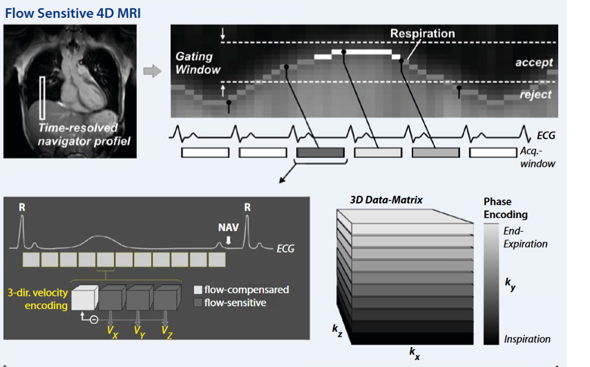 3D-Fluss-MRT in der Medizin?