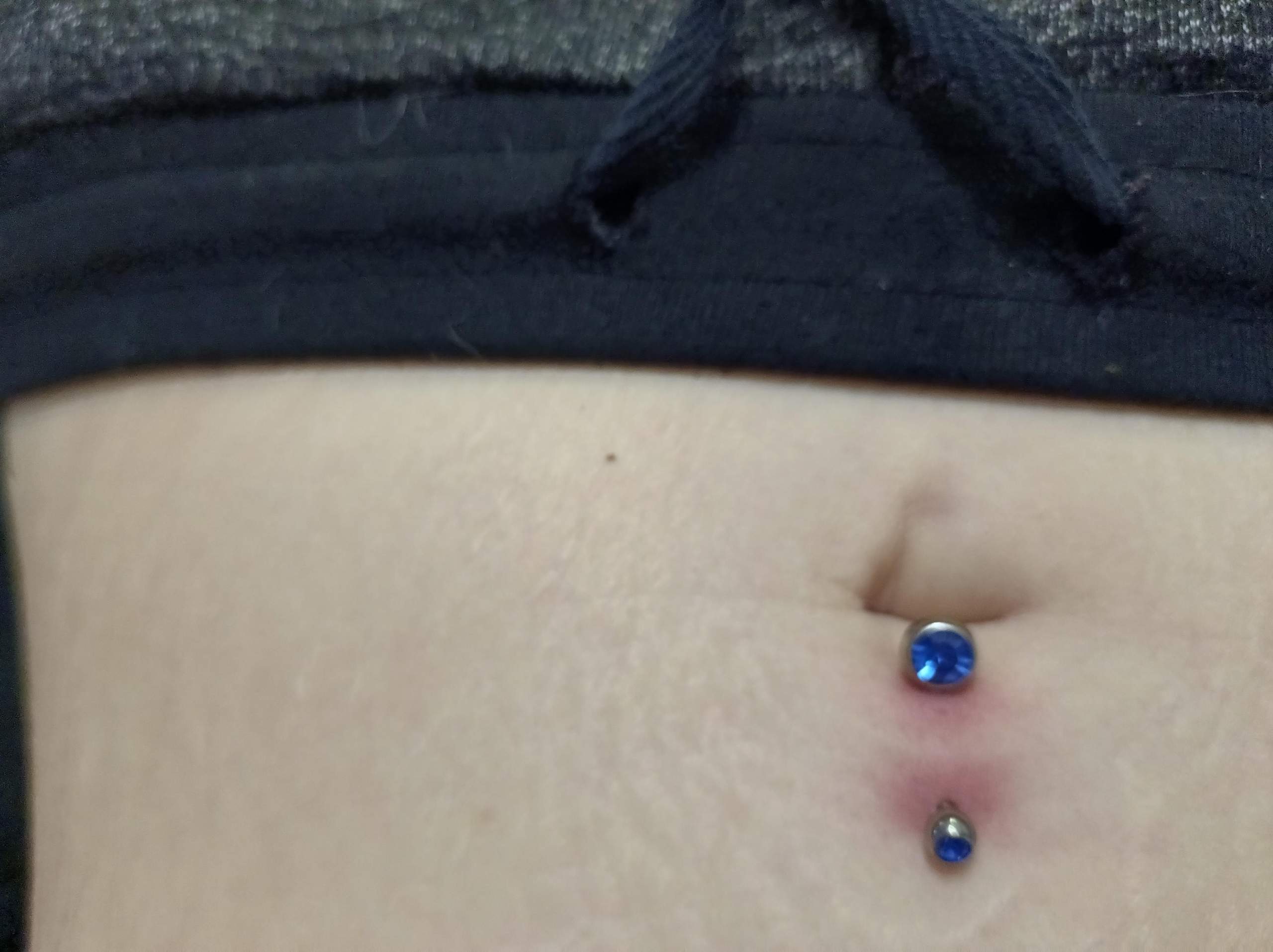 4 Tage Altes Bauchnabel Piercing Rot Und Juckt Bisschen Entz ndung 4-tage-altes-bauchnabel-piercing-rot-und-juckt-bisschen-entz-ndung