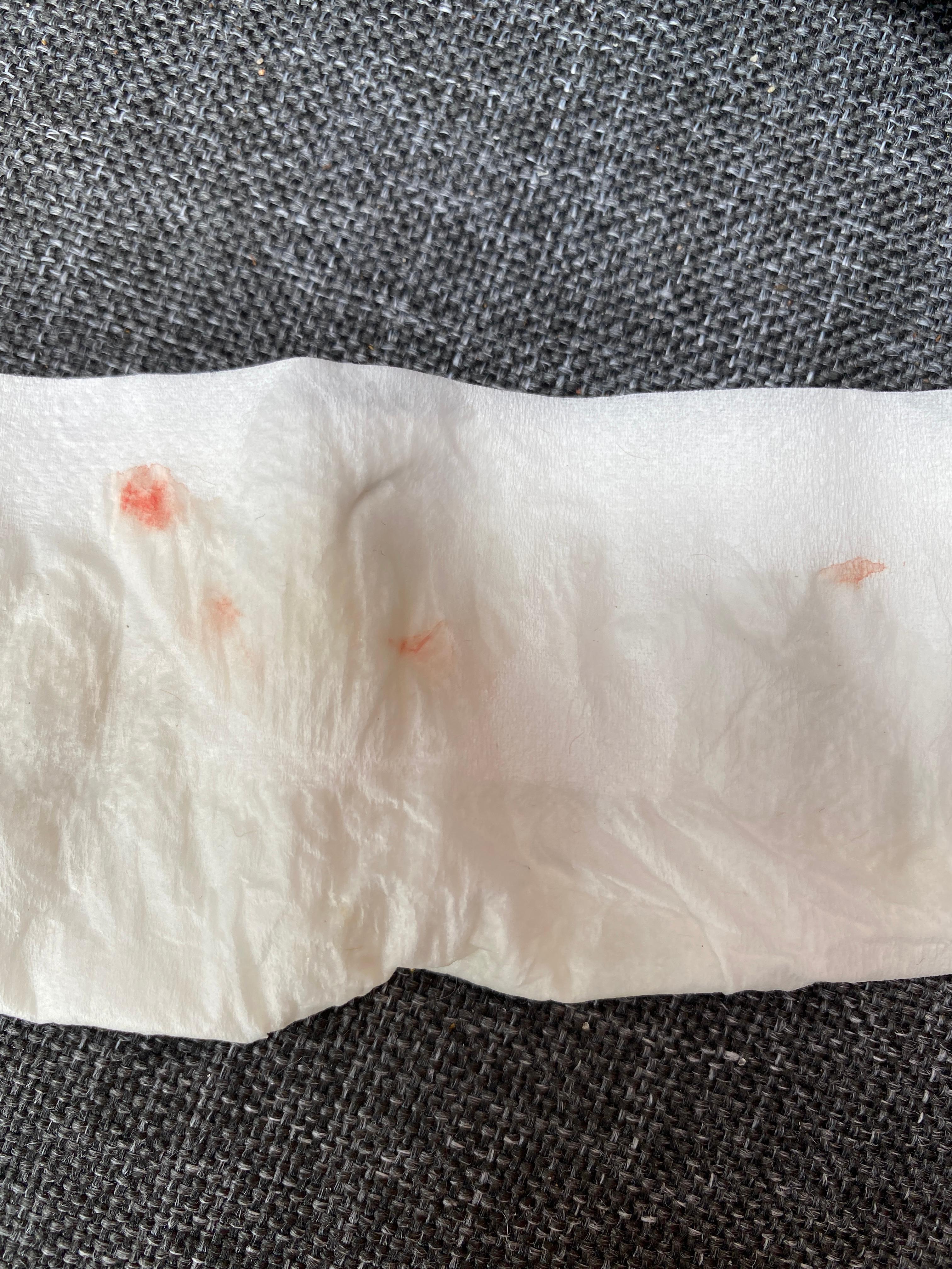 Ab Und Zu Blut In Spucke Spucken Ab Und Zu Blut In Spucke Spucken