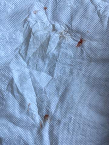 Ab Und Zu Blut In Spucke Spucken Ab Und Zu Blut In Spucke Spucken