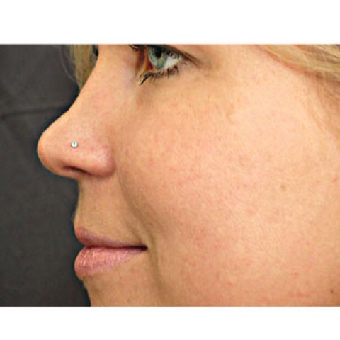 Ab Welchem Alter Ist Dieses Piercing Erlaubt Nasenpiercing Ab Welchem Alter Ist Dieses Piercing Erlaubt Nasenpiercing