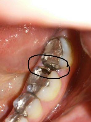 Abgebrochen Was Jetzt Zahnmedizin Abbrechen