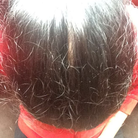 abstehende babyhaare gesundheit