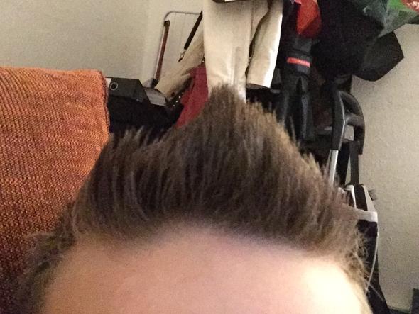 abstehende haare vorne links