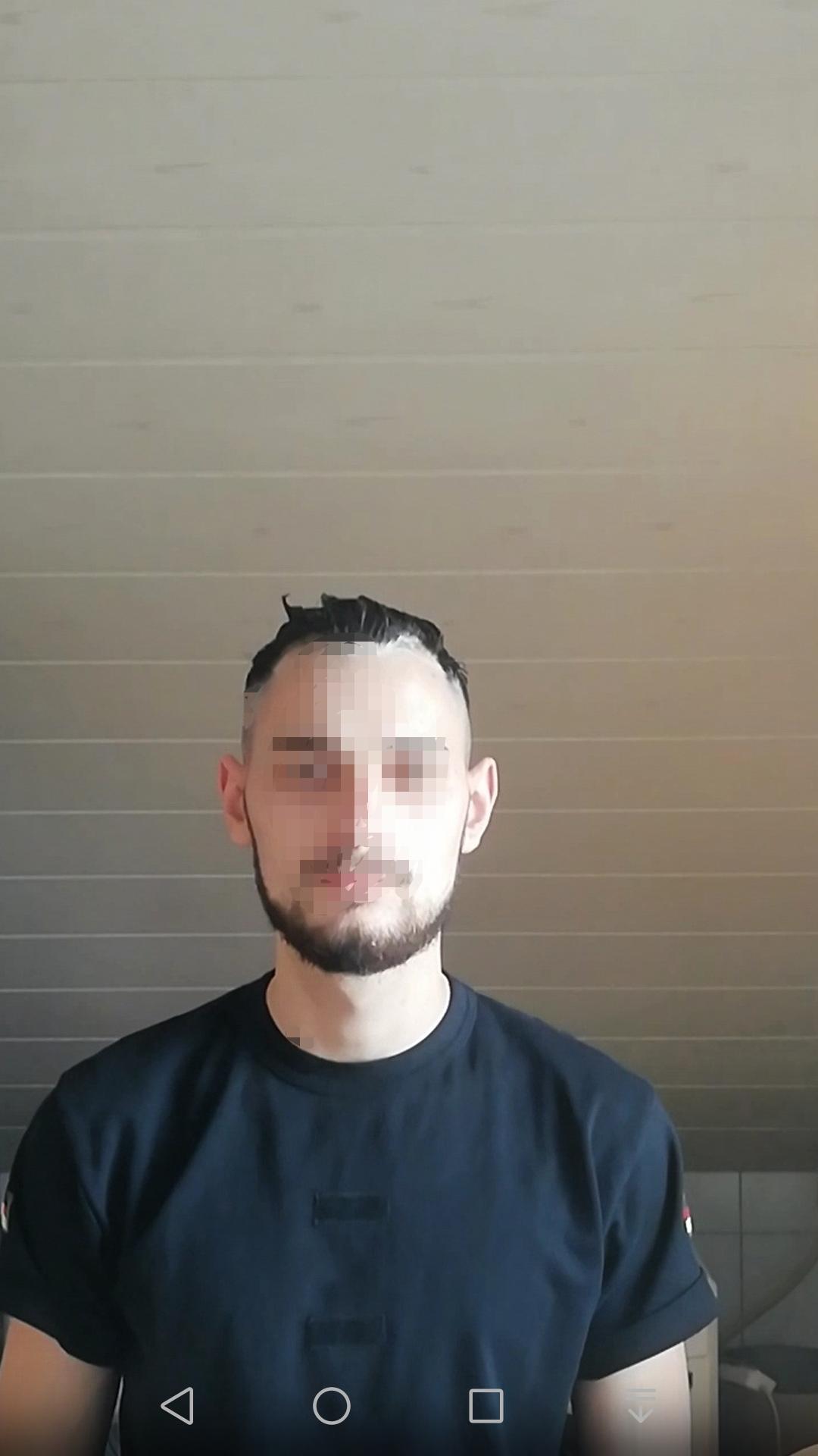 Abstehende Ohren Oder Normal Haare Beauty Aussehen