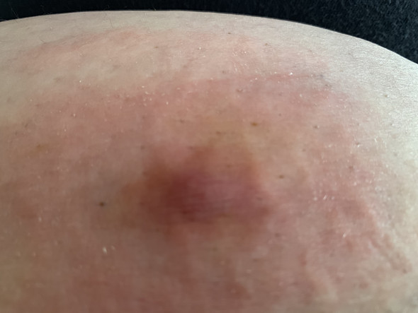 Atherom Die Meistgelesenen Fragen Atherom Die Meistgelesenen Fragen