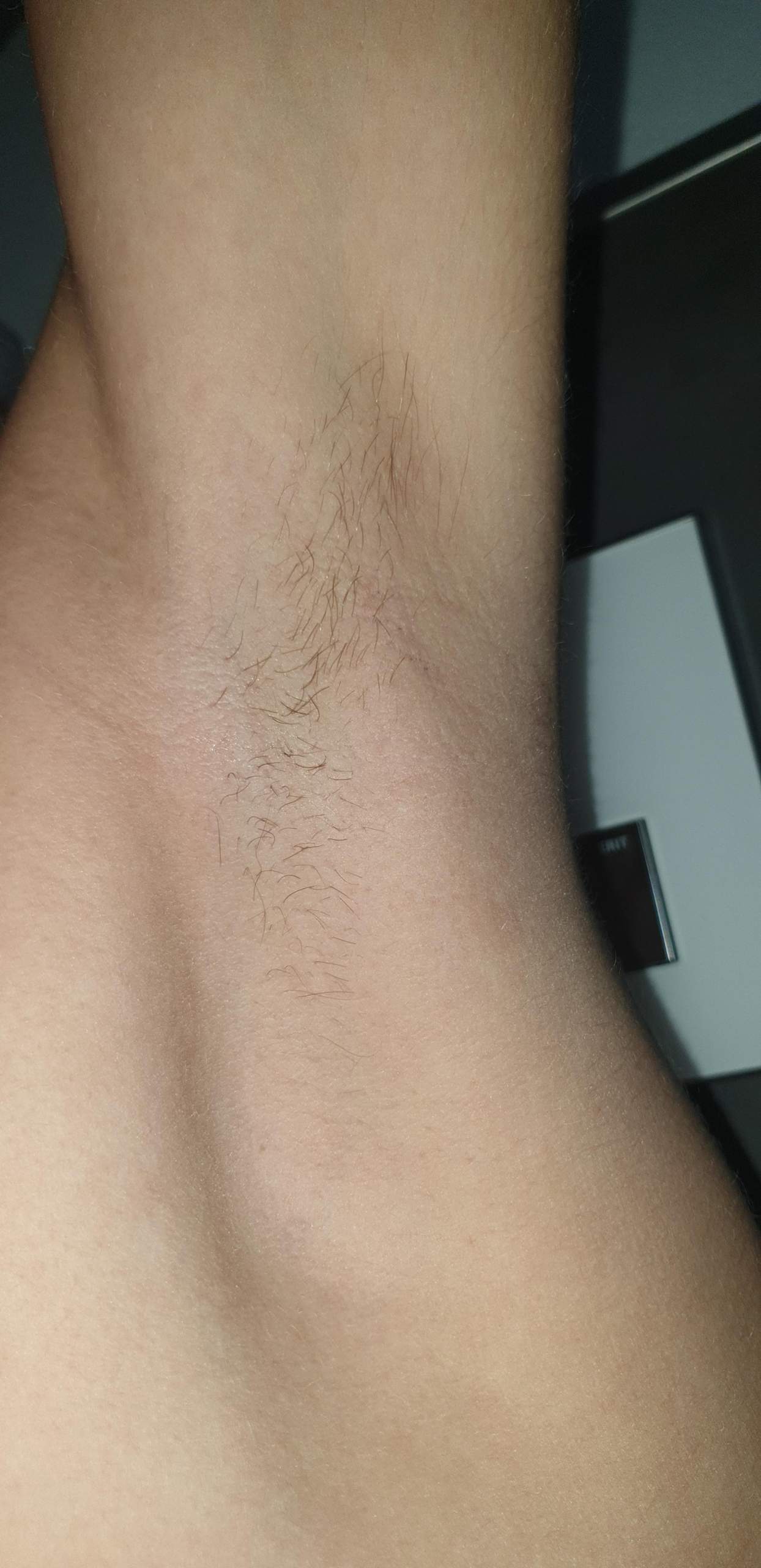 Axeln Rasieren Achseln rasieren? (Haare, Rasur)