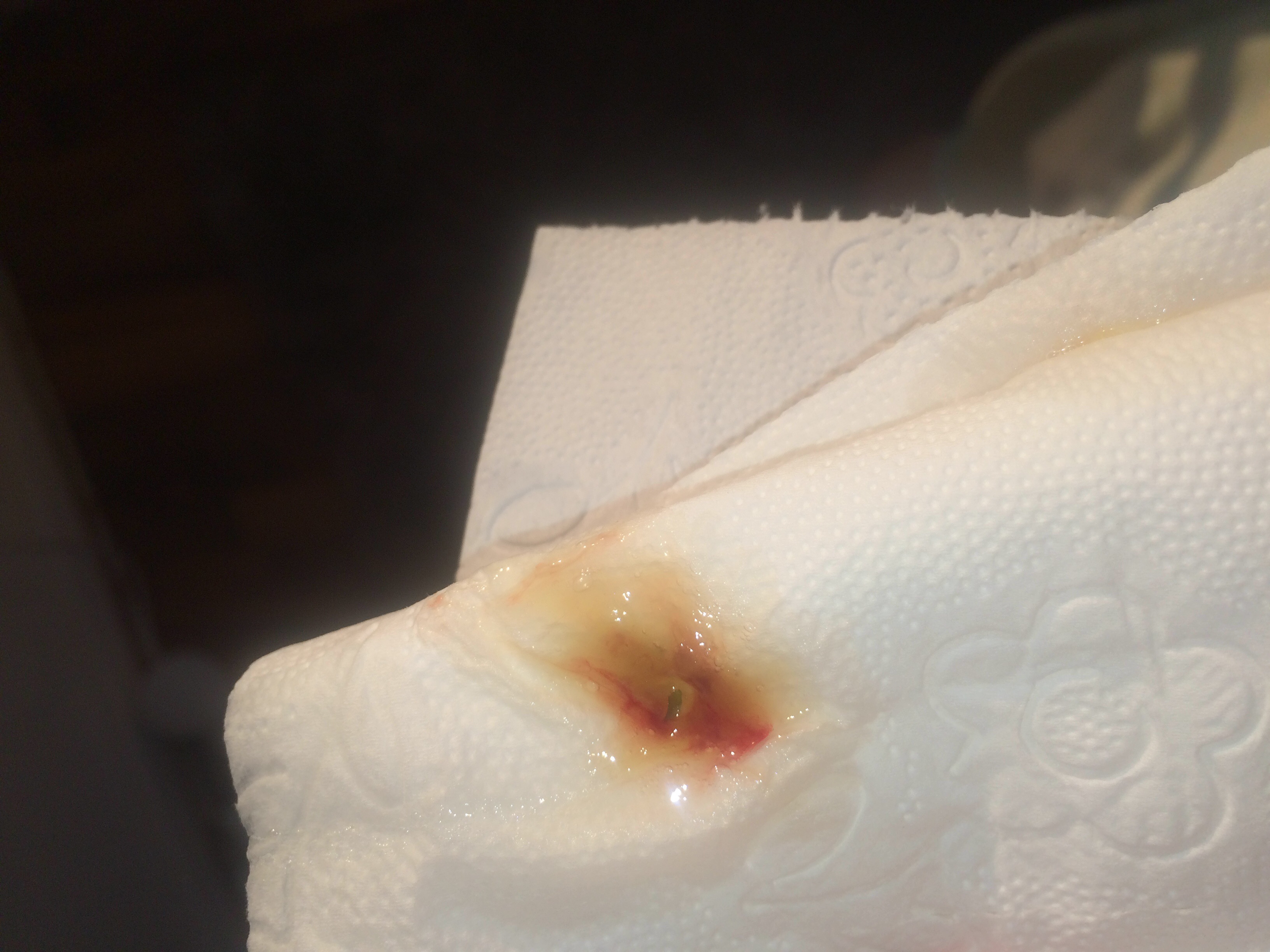 Achtun Ekelhaft, sieht das bedenklich aus habe wahrscheinlich Grippe? (normal, Notarzt) Achtun Ekelhaft, sieht das bedenklich aus habe wahrscheinlich Grippe? (normal, Notarzt)