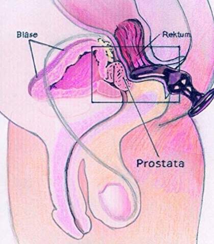 ACHTUNG SEXFRAGE: Wie lang sollte ein Analplug oder Dildo (inetwa) idealerweise mindestens sein - wenn man eines Mannes Prostata stimulieren mchte? (Sex, Anal) ACHTUNG SEXFRAGE: Wie lang sollte ein Analplug oder Dildo (inetwa) idealerweise mindestens sein - wenn man eines Mannes Prostata stimulieren mchte? (Sex, Anal)