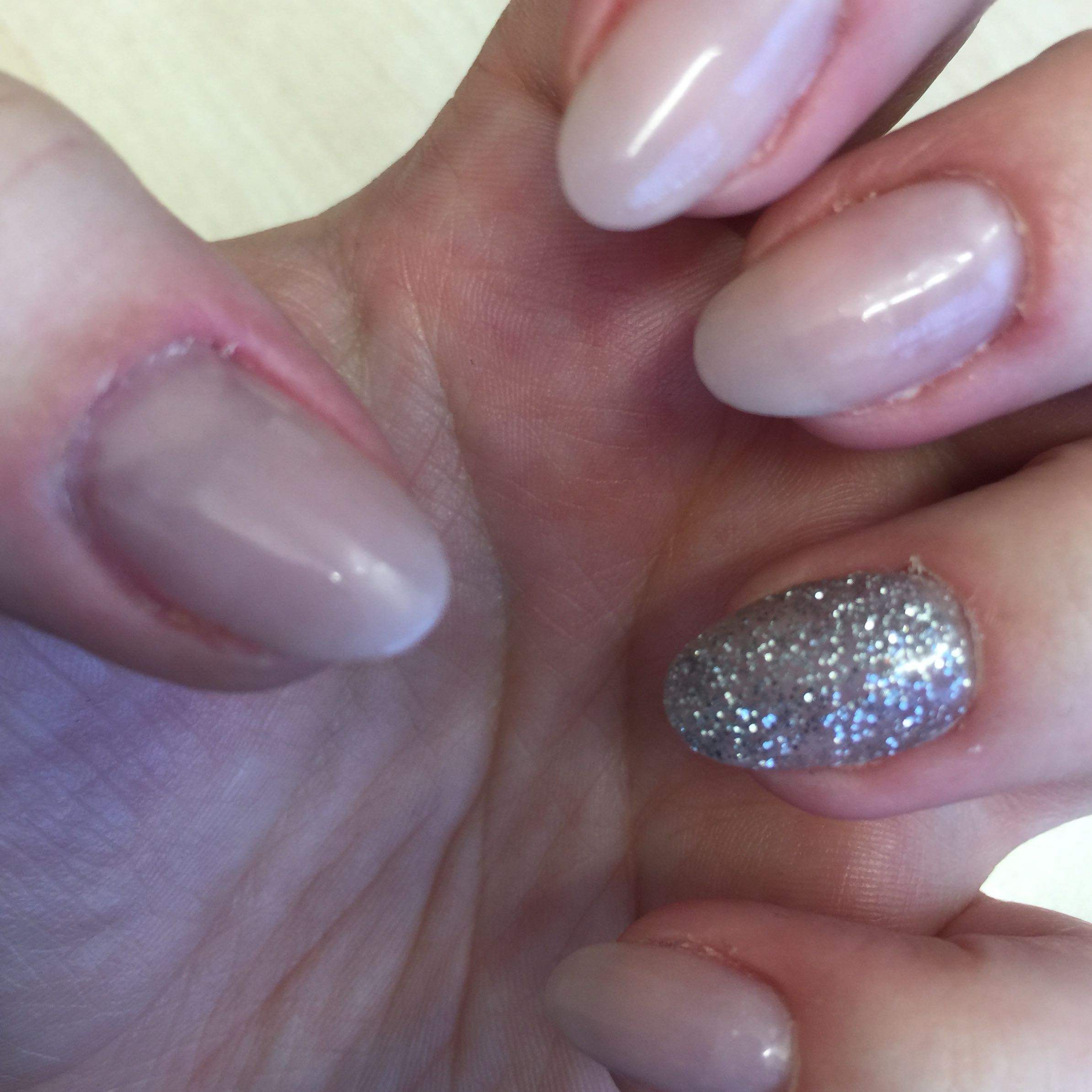 Wie Bekomme Ich Nagelkleber Vom Nagel