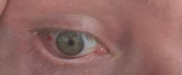 Bild zum Beitrag
