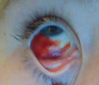 Mein Auge - (Medizin, Arzt, Augen)