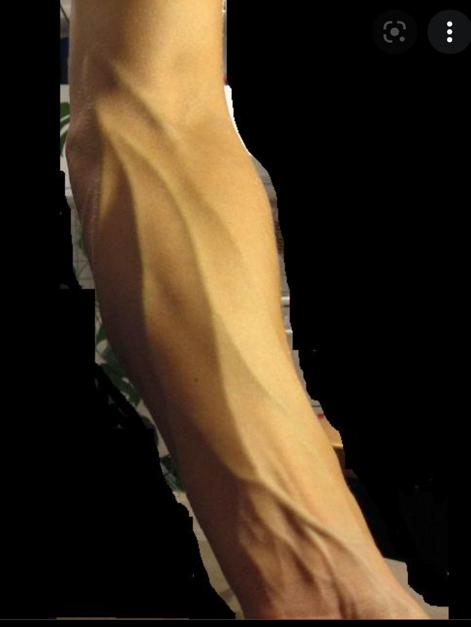 ADERN BEI DEN ARMEN SICHTBARER MACHEN xD? (Gesundheit und Medizin, Körper, Sport und Fitness)