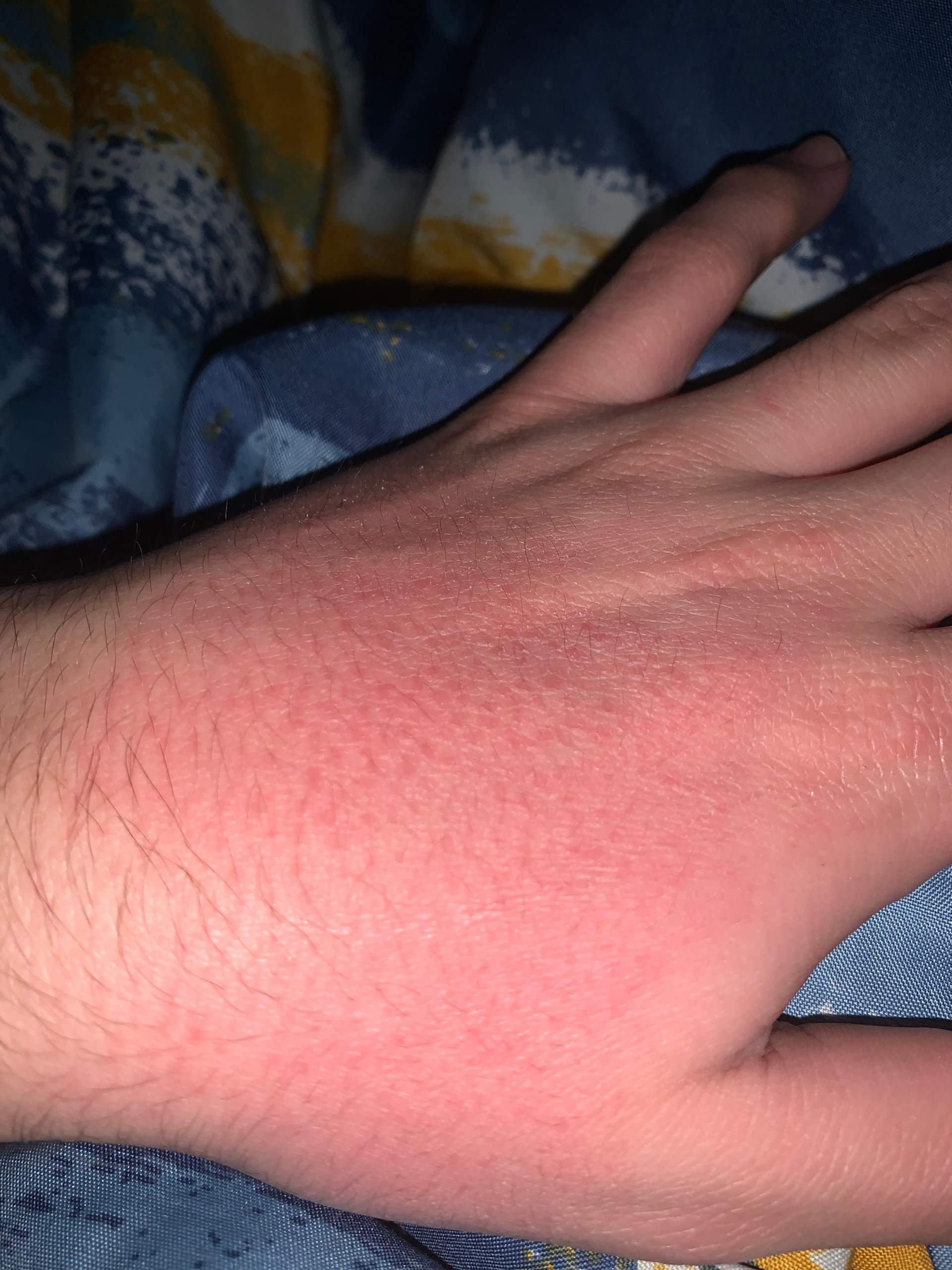 Roaccutane 30mg