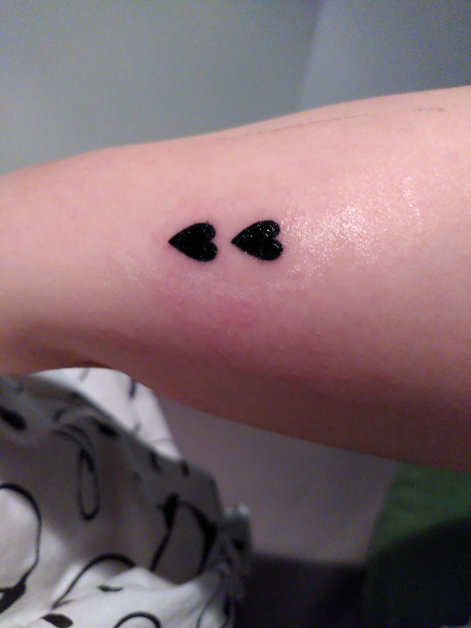 Allergie gegen Tattoo oder Entzündung? (Allergien und Unverträglichkeiten)