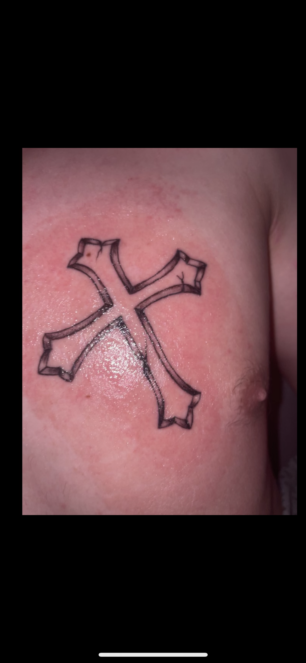 Allergische Reaktion Tattoo Gesundheit Und Medizin Tatowieren Tattoopflege