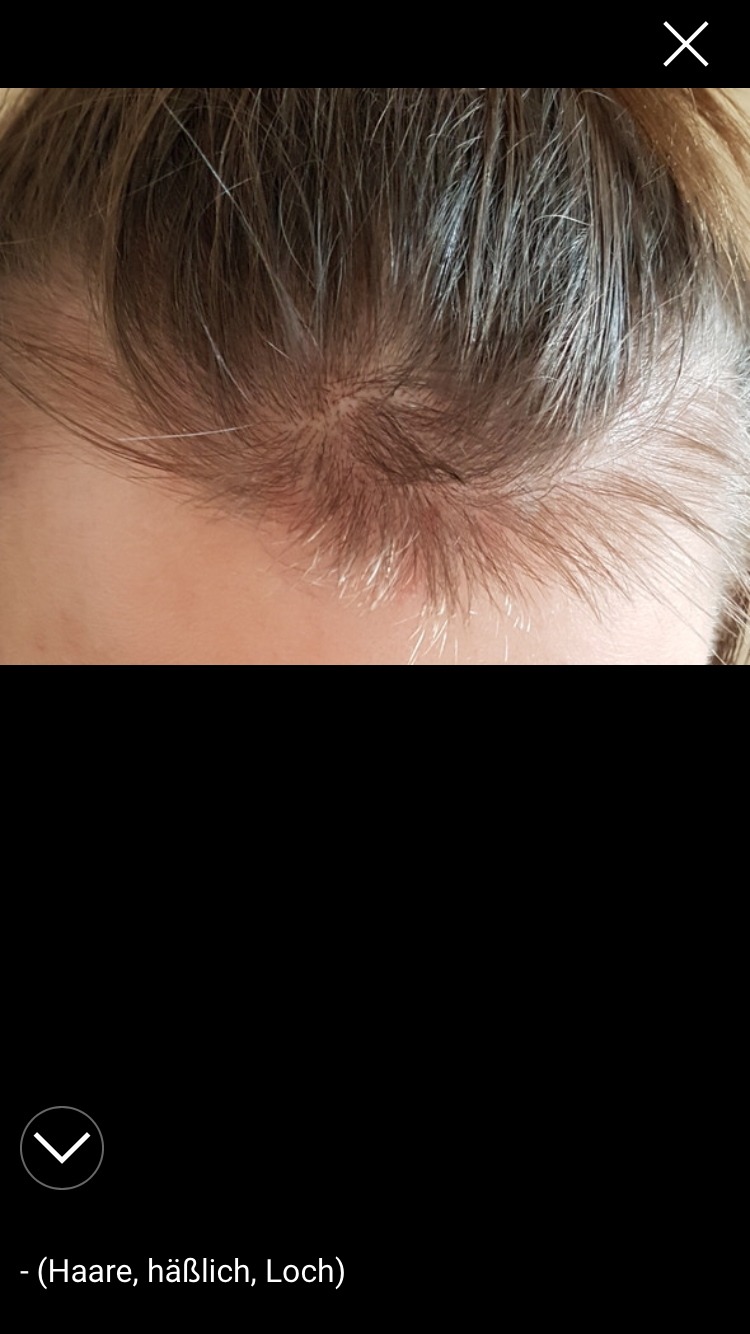 Als Ich Noch 11 War Hab Ich Mir Die Rasiert Weil Es Richtig Nervig War Ich Nehme Jetzt Ein Bild Von Google Was Ich Gefunden Habe Rasieren Babyhaare