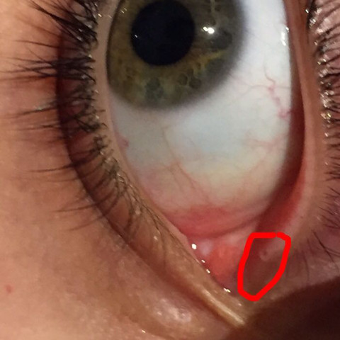 Am Augen So Ein Brennen Ist Das Normal Gesundheit Am Augen So Ein Brennen Ist Das Normal Gesundheit