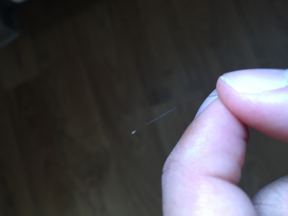 An Der Haarwurzel Klebt Irgendetwas Warum Und Wie Bekommt Man Es Weg Hautarzt Hat So Etwas Noch Nie Gesehen Schuppen