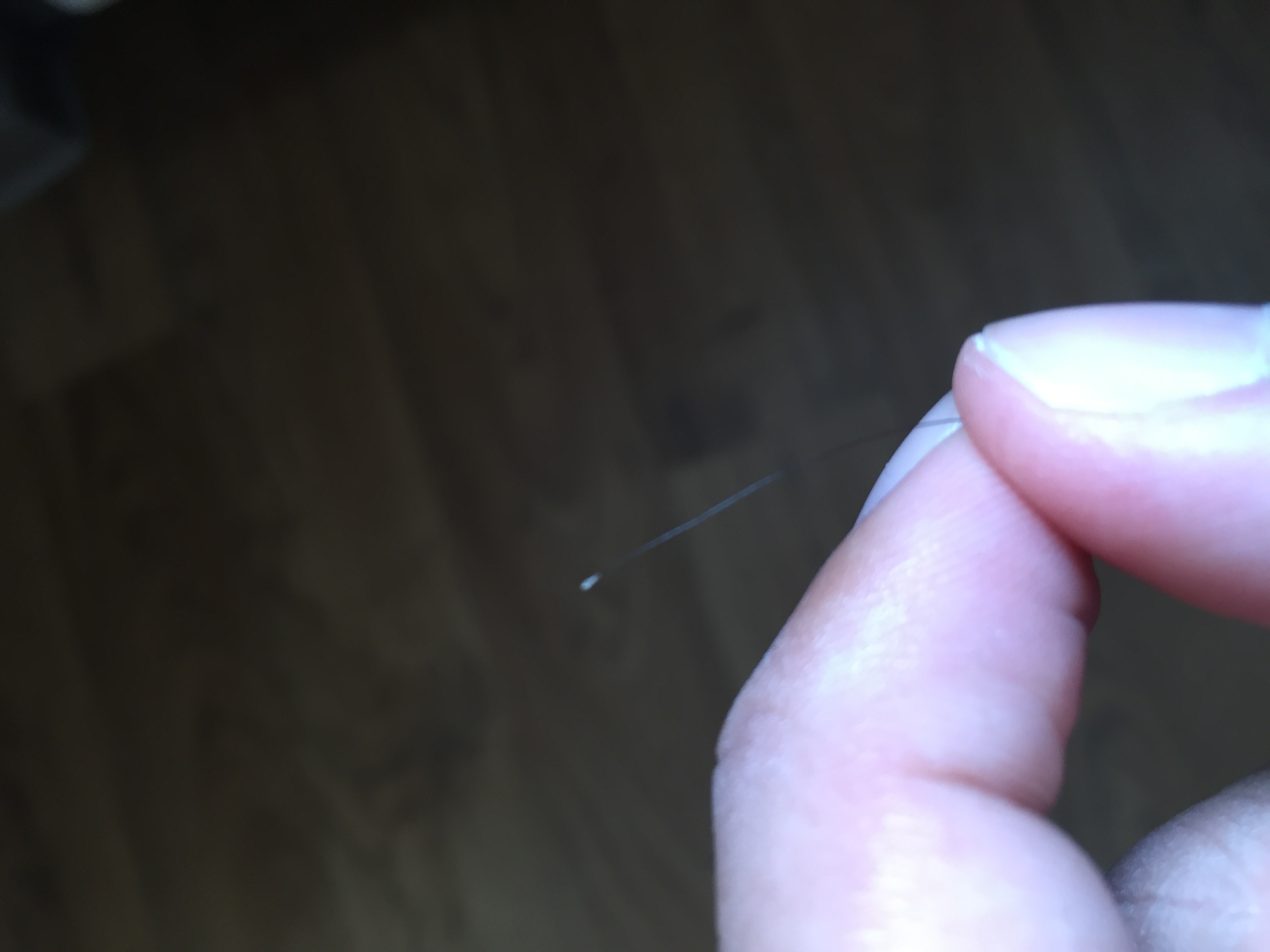 An Der Haarwurzel Klebt Irgendetwas Warum Und Wie Bekommt Man Es Weg Hautarzt Hat So Etwas Noch Nie Gesehen Schuppen