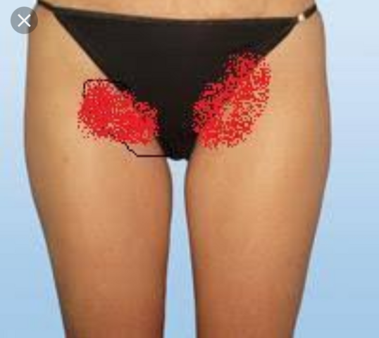 intimbereich sichtbare stoppeln