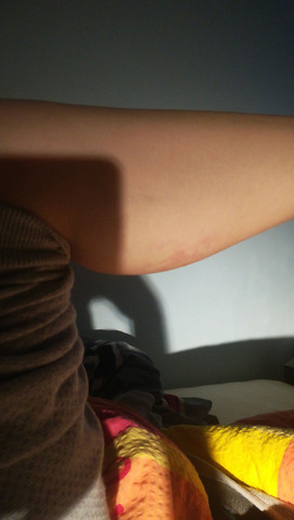 angst vor thrombose