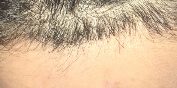 ansatz weggeschnitten jetzt stoppeln