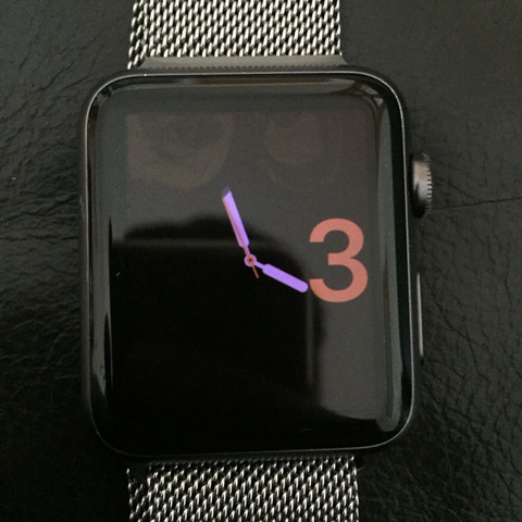 Hier sieht man ein Bild der Apple Watch mit den Flecken - (Sport, Apple, iPhone)
