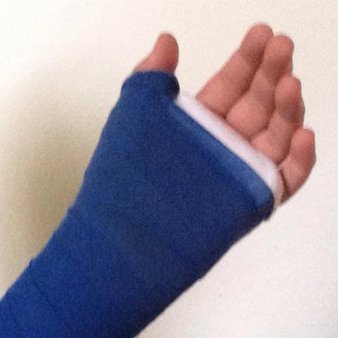 Arm Gebrochen Sa Schreiben Schule Gesundheit Arm Gebrochen Sa Schreiben Schule Gesundheit