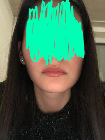 Assymetrisches Schiefes Gesicht Hilfe Gesundheit Und Medizin