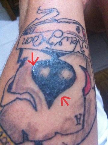 Auf Dem Tattoo Sind Viele Pickel Gesundheit Wasser Sonne Auf Dem Tattoo Sind Viele Pickel Gesundheit Wasser Sonne