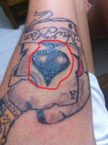 Auf Dem Tattoo Sind Viele Pickel Gesundheit Wasser Sonne Auf Dem Tattoo Sind Viele Pickel Gesundheit Wasser Sonne