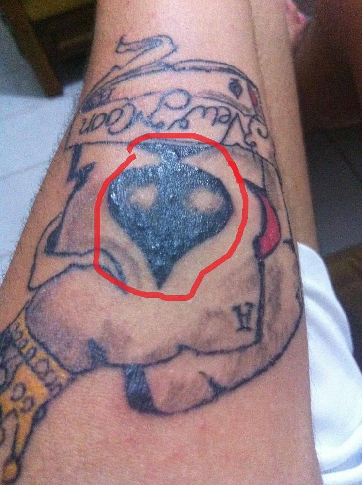 Auf dem Tattoo sind viele Pickel! (Gesundheit, Wasser, Sonne)