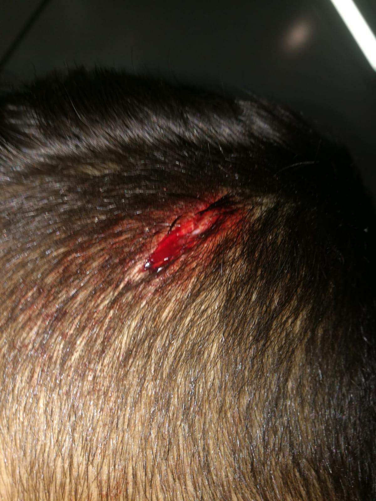 Auf Den Kopf Gefallen Alles Gut Gesundheit Sturz Auf Den Kopf Gefallen Alles Gut Gesundheit Sturz