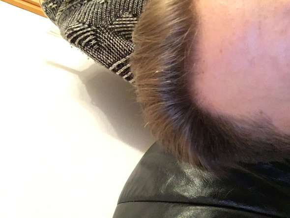 Rechts - (Gesundheit, Haare)