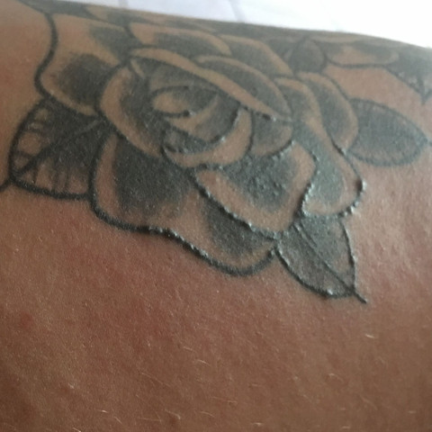 Bild vom Tattoo - (Pickel, Tattoo, Ausschlag)