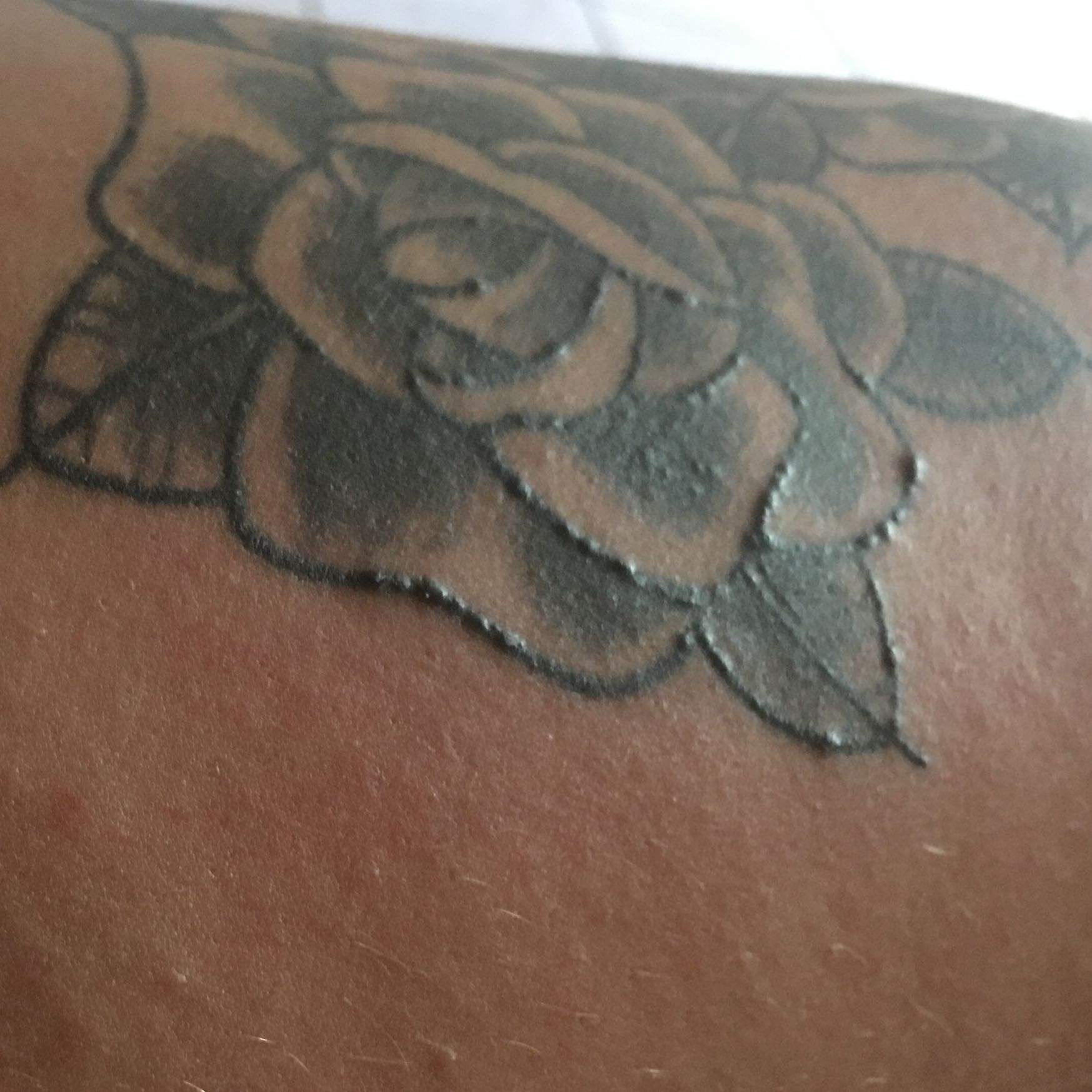 Auf einmal Ausschlag auf dem Tattoo? (Pickel)