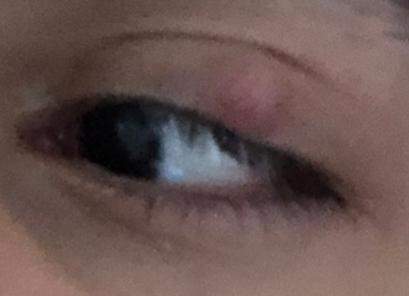 Auf Linke Auge Verschwommen Gesundheit Und Medizin Gesundheit Medizin Auf Linke Auge Verschwommen Gesundheit Und Medizin Gesundheit Medizin